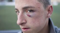 Un juvenil, hospitalizado tras ser golpeado con un casco de moto