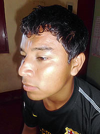 Le fracturan el tabique nasal a un árbitro en Perú
